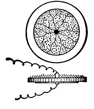 FIG. 10.- TENSION APPLIED TO DISC BY MEANS OF ENLARGED ELECTRODE.
